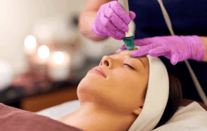 Que tipos de tratamientos faciales en Sevilla hay