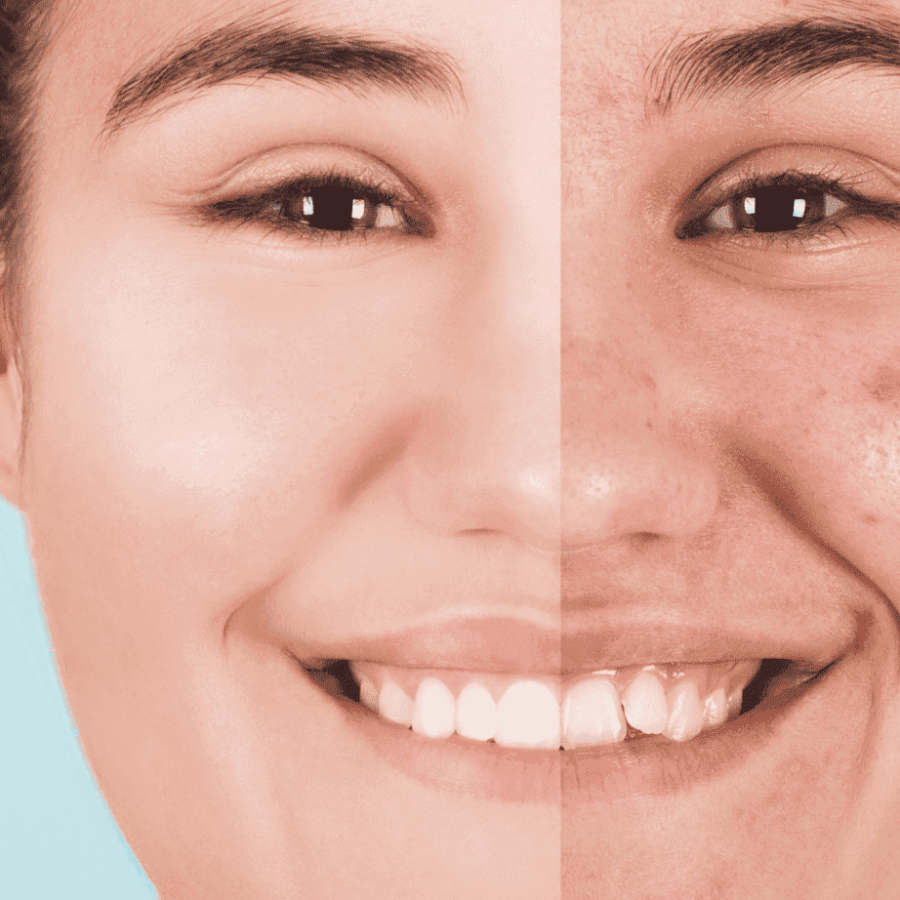 Acne-en-Sevilla