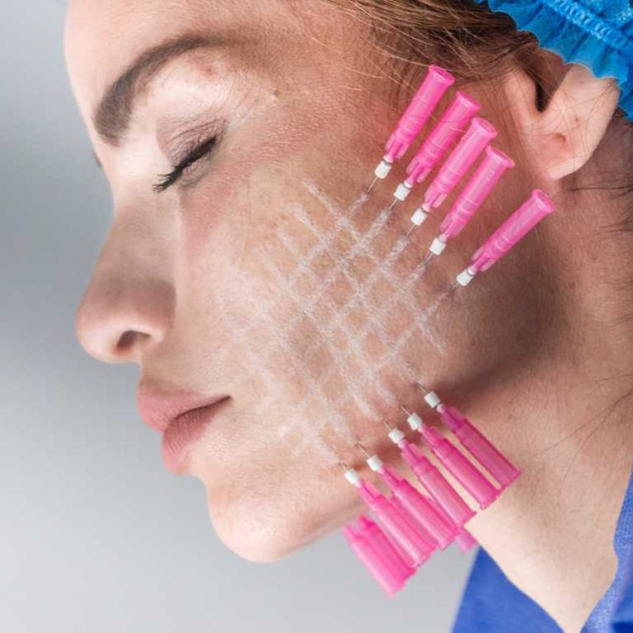 Hilos Tensores En Sevilla